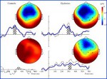 From Clinical Neurophysiology, Feb 2013