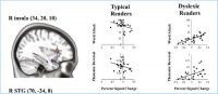 diagram showing brain activation patterns
