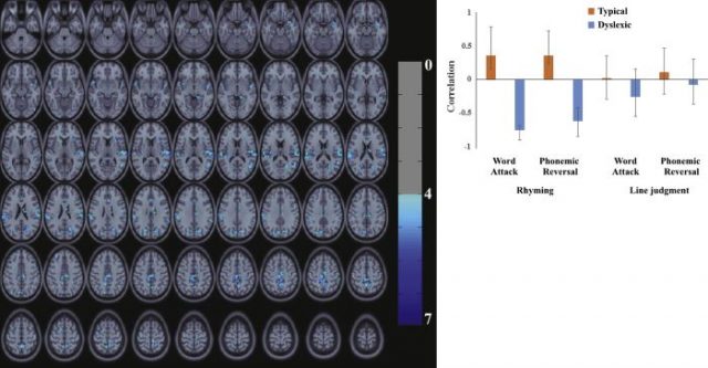 brain scan images