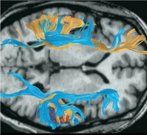 brain fiber tract images